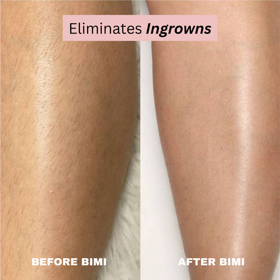 Veliss Electric Trimmer 2.0